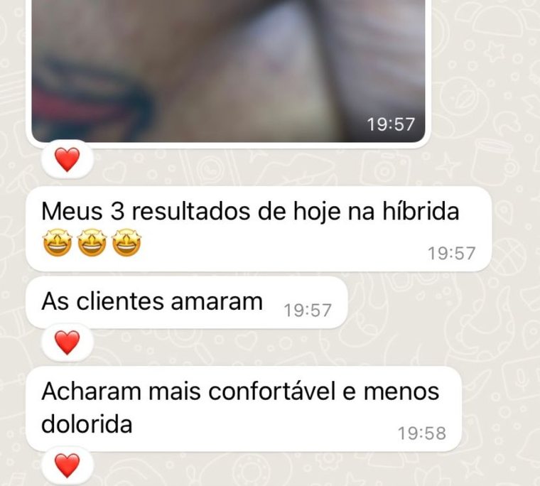 Aluna relata três atendimentos no mesmo dia com a Técnica Híbrida